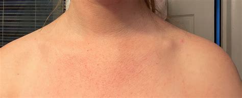 Any help or advice is appreciated Edit: It doesn't feel like muscle but. . Lump on sternum reddit